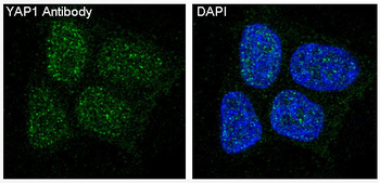 YAP1 Rabbit mAb