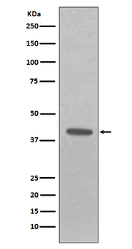 EpCAM Rabbit mAb Antibody