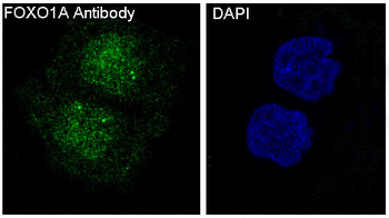 FoxO1a Rabbit mAb Antibody