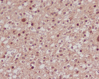 FoxO1a Rabbit mAb Antibody