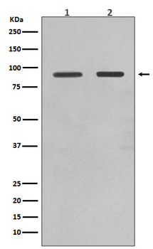 FoxO1a Rabbit mAb Antibody