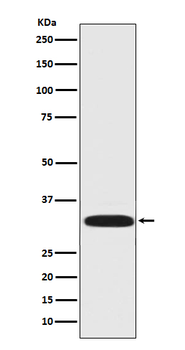 DARPP32 Rabbit Monoclonal Antibody