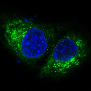 Bak Rabbit mAb Antibody