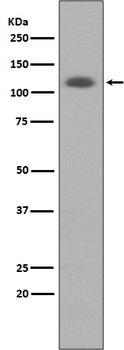 ABCG1 Rabbit mAb Antibody