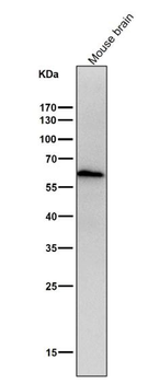 ELK1 Rabbit mAb