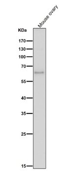 ELK1 Rabbit mAb
