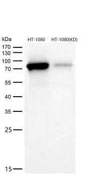 PKC alpha Rabbit mAb [KD Validated] Antibody