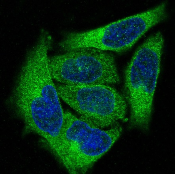 PKC alpha Rabbit mAb [KD Validated]