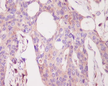 PKC alpha Rabbit mAb [KD Validated]