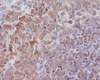 SHP1 Rabbit mAb Antibody