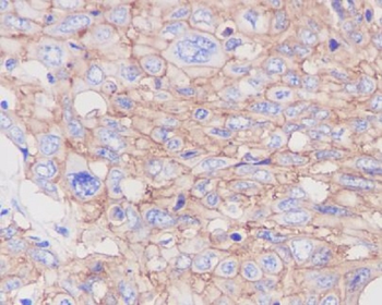 GLUT1 Rabbit mAb Antibody