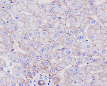 SCARB1 Rabbit mAb Antibody