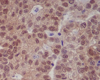 p16 INK Rabbit mAb Antibody