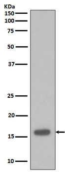 p16 INK Rabbit mAb Antibody