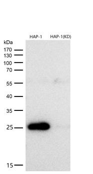 p27 KIP 1 Rabbit mAb [KD Validated]