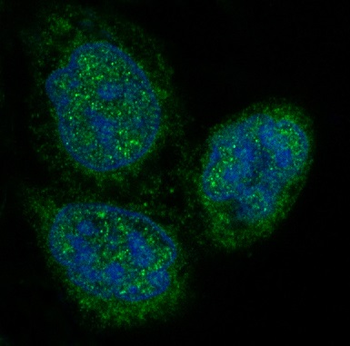 p27 KIP 1 Rabbit mAb [KD Validated]