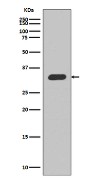 p27 KIP 1 Rabbit mAb [KD Validated]