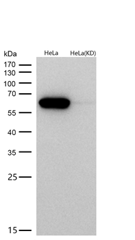 Calreticulin Rabbit mAb [KD Validated]
