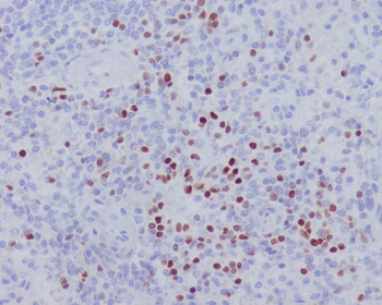 LEF1 Rabbit mAb Antibody