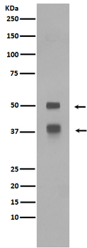 LEF1 Rabbit mAb Antibody