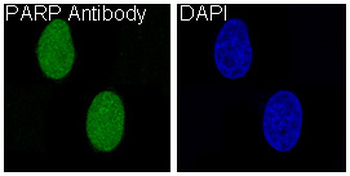 PARP Rabbit mAb Antibody