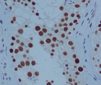 PARP Rabbit mAb Antibody
