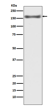 ASK1 Rabbit mAb Antibody