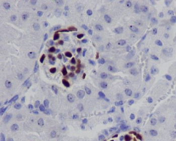 Wilms Tumor Protein Rabbit mAb Antibody
