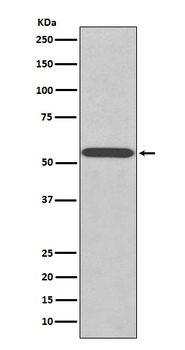 Wilms Tumor Protein Rabbit mAb Antibody