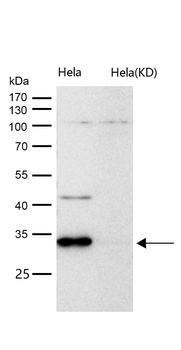 Cathepsin D Rabbit mAb [KD Validated]