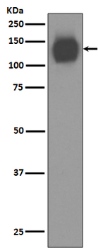 CD31 Rabbit mAb Antibody