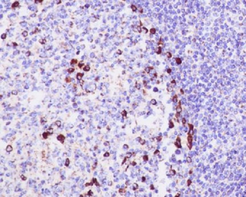 CD9 Rabbit mAb Antibody