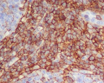 CD90 / Thy1 Rabbit mAb Antibody