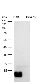 beta 2 Microglobulin Rabbit mAb [KD Validated] Antibody