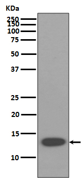 beta 2 Microglobulin Rabbit mAb [KD Validated] Antibody