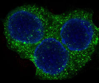ROCK1 Rabbit mAb Antibody