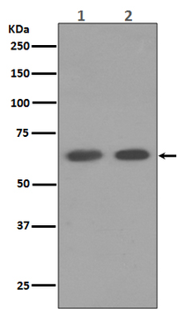 AMPK alpha 1 Rabbit mAb [KD Validated]