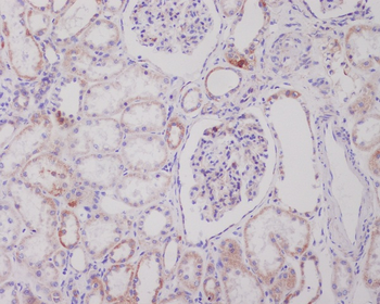 PI 3 Kinase Class 3 Rabbit Monoclonal Antibody