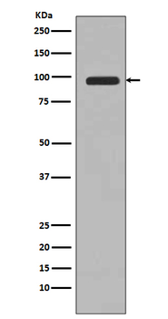 PI 3 Kinase Class 3 Rabbit Monoclonal Antibody