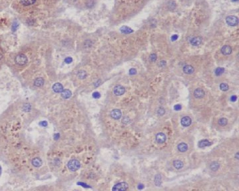 Glutamine Synthetase Rabbit mAb