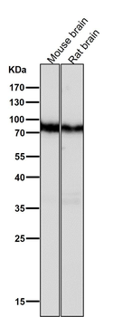 B Raf Rabbit mAb Antibody