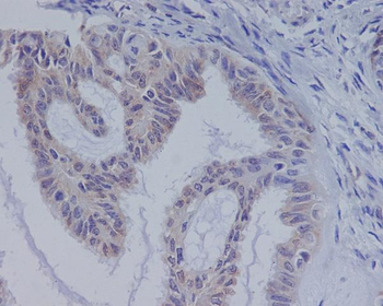 B Raf Rabbit mAb Antibody