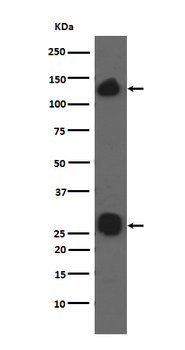 Integrin alpha V Rabbit mAb Antibody