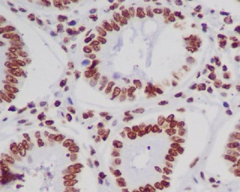 Histone H4 (acetyl K5) Rabbit mAb Antibody