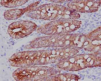 Cytokeratin 19 Rabbit mAb Antibody
