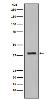 Cytokeratin 19 Rabbit mAb Antibody