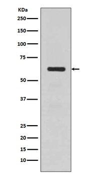 TGFBI Rabbit mAb Antibody