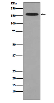 KMT4 / Dot1L Rabbit mAb Antibody