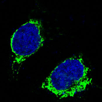 Bim Rabbit mAb Antibody