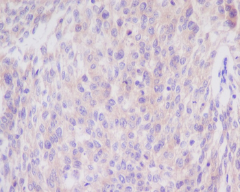 Bim Rabbit mAb